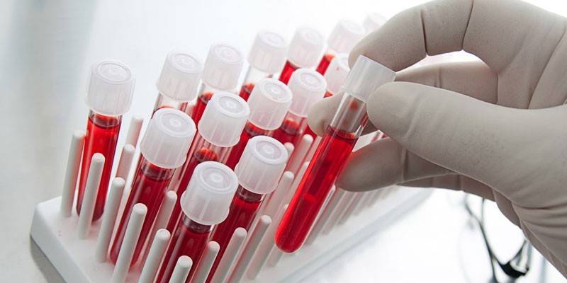 Аналіз крові при лейкозі загальний і біохімічний - за якими параметрами захворювання розпізнають