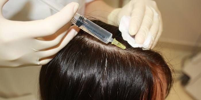Мезотерапія для волосся голови: препарати і коктейлі для росту і лікування