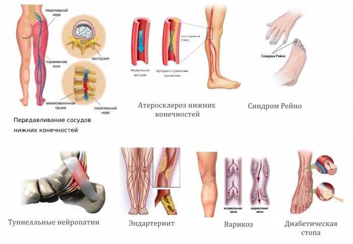 Причини і лікування холодних ніг у людини