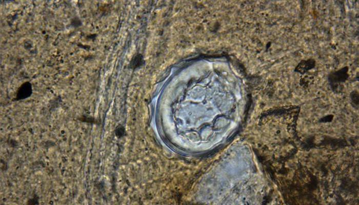 Яйця глистів в організмі людини: як виглядають і як здавати аналіз