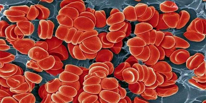Еритроцити в крові підвищені у дитини, чоловіки чи жінки, - що означає в аналізі і як знизити
