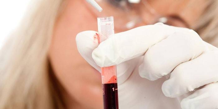 Аналіз на імунний статус - як здати кров на дослідження і розшифрувати імунограму