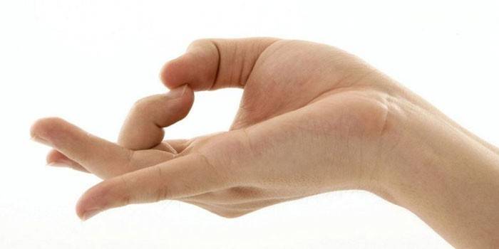 Сверблять пальці на руках: причини і лікування