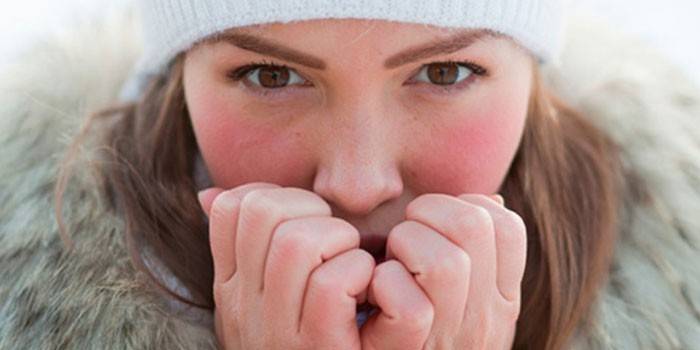 Холодова алергія у дитини і дорослого - ознаки, прояви, симптоми і лікування