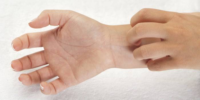 Мазь від екземи: антибактеріальні та протигрибкові засоби для лікування шкіри