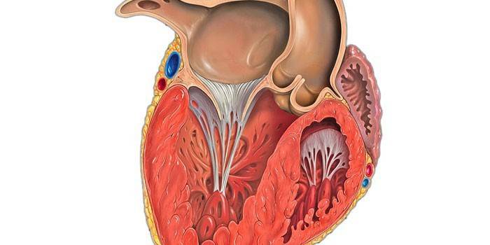 Гіпертрофія лівого шлуночка - ознаки і причини, лікування кардіоміопатії