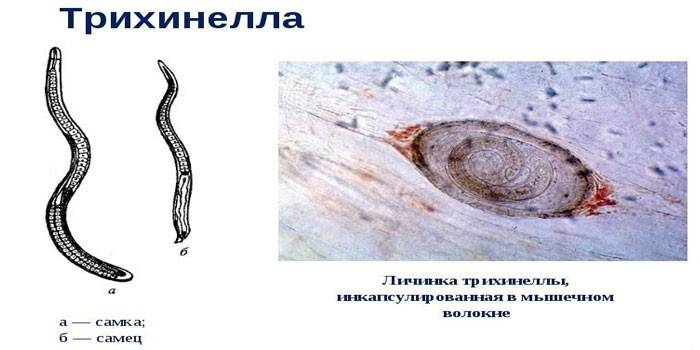 Життєвий цикл трихінел: розмір, форма і схема розвитку хробака, як можна заразитися Trichinella spiralis