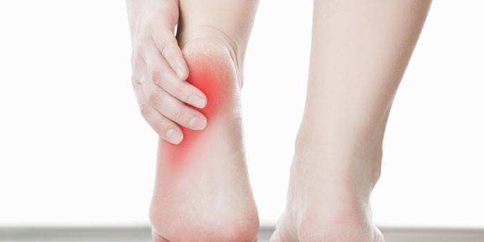 Чому болять п'яти - що робити і як лікувати: діагностика і профілактика хвороб ніг