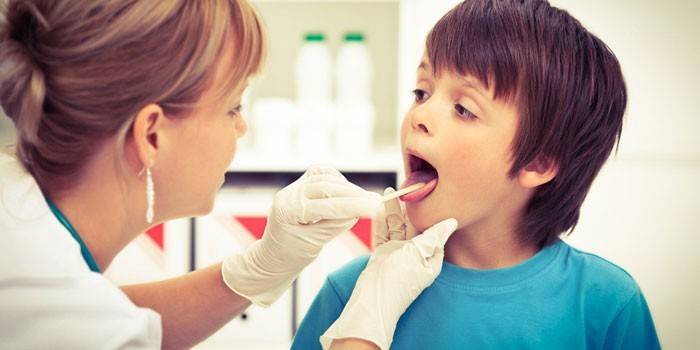 Герпес в горлі у дитини - прояви вірусної інфекції, як і чим лікувати