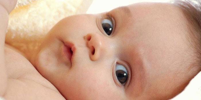 Внутрішньочерепний тиск у немовлят: як визначити і лікувати захворювання