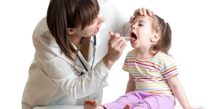 Мононуклеоз у дітей: симптоми і лікування хвороби