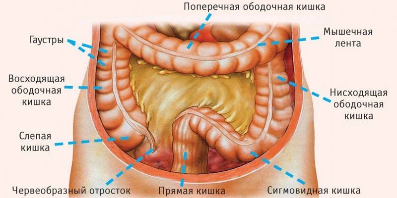 Ендометріоз кишечника - симптоми, причини та стадії захворювання, медикаментозна терапія