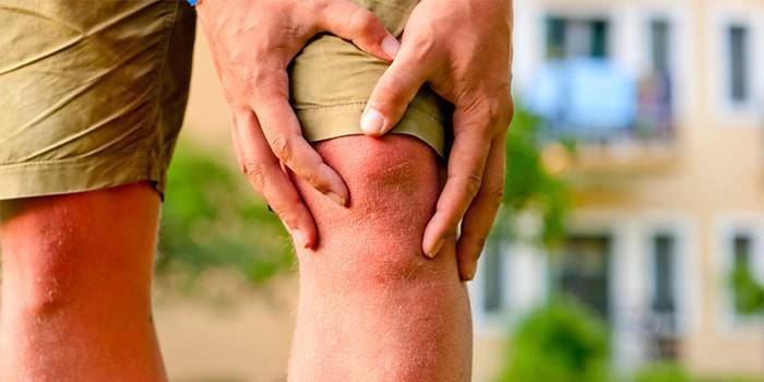 Деформуючий остеоартроз колінного суглоба: як лікувати патологію