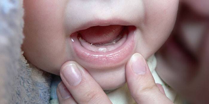 Ознаки прорізування зубів у немовлят, можливі реакції організму і зміни в поведінці дитини