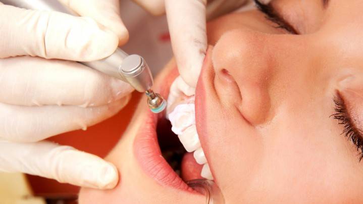 Гігієнічна чистка зубів - як чистять зубний камінь і наліт, вартість стоматологічної процедури