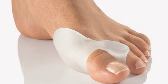 Коректор для великого пальця ноги при вальгусной деформації