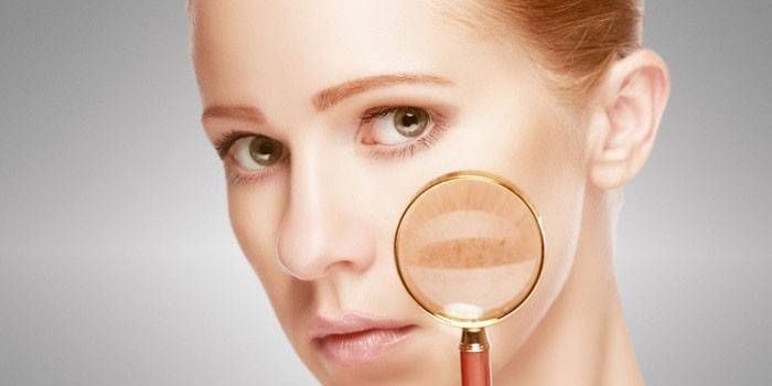 Засіб від пігментних плям на обличчі - найбільш ефективні медикаментозні, народні та косметичні