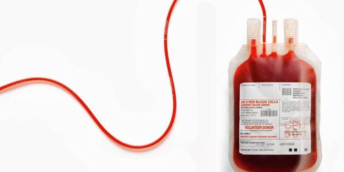 Переливання крові - показання та протипоказання, схема і сумісність груп при гемотрансфузії
