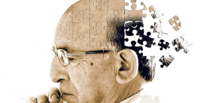Хвороба Альцгеймера - це: причини, стадії та ознаки