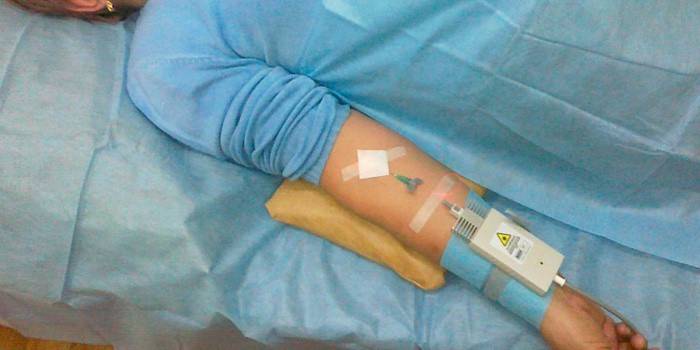 Очищення крові лазером: протипоказання для лікування, процедура застосування
