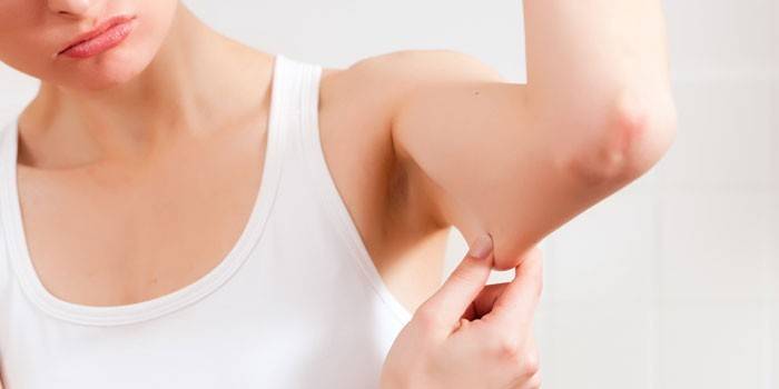 Підтягнути шкіру після схуднення в домашніх умовах - як позбутися від в'ялого тіла і відновити тонус